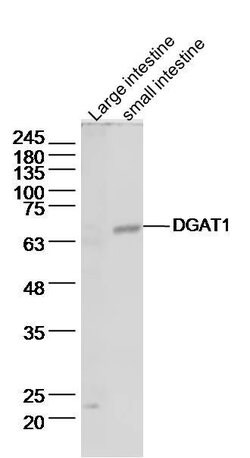 DGAT1/Diglyceride acyltransferase Rabbit anti-Human, Polyclonal, Bioss