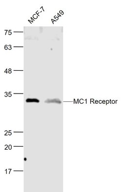MC1 Receptor Rabbit anti-Human, Polyclonal, Bioss 100 &mu;L; Unconjugated:Antibodies,