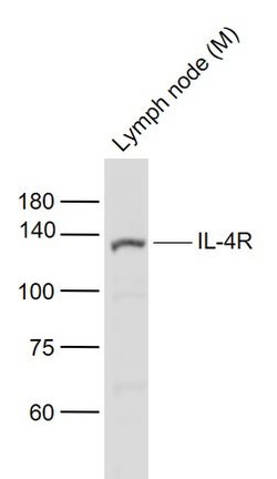 IL-4R Polyclonal Antibody, Bioss 100 &mu;L | Buy Online | Bioss | Fisher Scientific