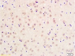 PITX3 Polyclonal Antibody, Bioss 100 &mu;L | Buy Online | Bioss | Fisher Scientific