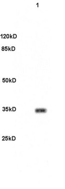 PITX3 Polyclonal Antibody, Bioss 100 &mu;L | Buy Online | Bioss | Fisher Scientific