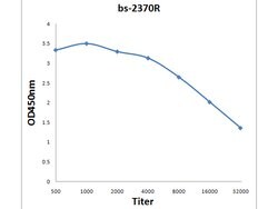 FABP5 Rabbit anti-Human, Polyclonal, Bioss 100 &mu;L; Unconjugated:Antibodies,