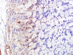 FABP5 Rabbit anti-Human, Polyclonal, Bioss 100 &mu;L; Unconjugated:Antibodies,