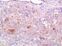CNR2/CB2 Rabbit anti-Human, Polyclonal, Bioss 100 &mu;L; Unconjugated:Antibodies,