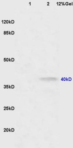 CNR2/CB2 Rabbit anti-Human, Polyclonal, Bioss 100 &mu;L; Unconjugated:Antibodies,