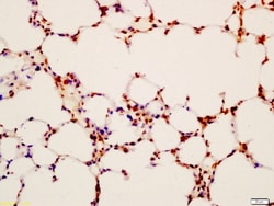 LAMP2 Rabbit anti-Human, Polyclonal, Bioss 100 &mu;L; Unconjugated:Antibodies,