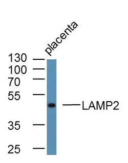 LAMP2 Rabbit anti-Human, Polyclonal, Bioss 100 &mu;L; Unconjugated:Antibodies,