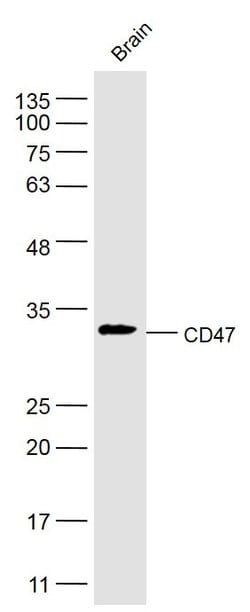 CD47/MER6 Rabbit anti-Human, Polyclonal, Bioss 100 &mu;L; Unconjugated:Antibodies,