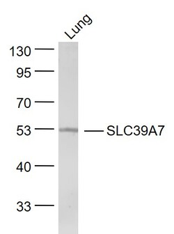 SLC39A7 Rabbit anti-Human, Polyclonal, Bioss 100 &mu;L; Unconjugated:Antibodies,