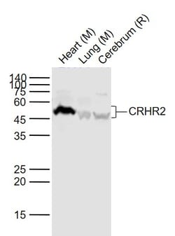 CRHR2 Polyclonal Antibody, Bioss 100 &mu;L; Unconjugated:Antibodies, Polyclonal