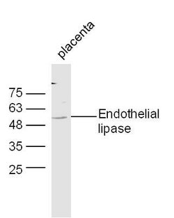 Endothelial lipase Rabbit anti-Human, Polyclonal, Bioss 100 &mu;L; Unconjugated:Antibodies,