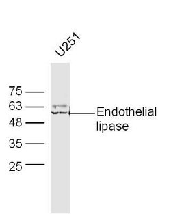 Endothelial lipase Rabbit anti-Human, Polyclonal, Bioss 100 &mu;L; Unconjugated:Antibodies,