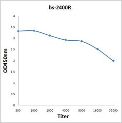MDC1 Rabbit anti-Human, Polyclonal, Bioss 100 &mu;L; Unconjugated:Antibodies,