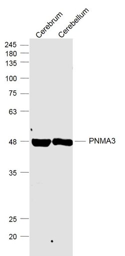 PNMA3 Rabbit anti-Human, Polyclonal, Bioss 100 &mu;L; Unconjugated:Antibodies,