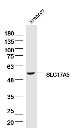 SLC17A5 Rabbit anti-Human, Polyclonal, Bioss 100 &mu;L; Unconjugated:Antibodies,