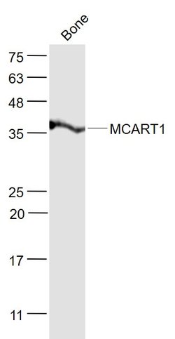 MCART1 Rabbit anti-Human, Polyclonal, Bioss 100 &mu;L; Unconjugated:Antibodies,