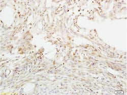 ABP/SHBG Rabbit anti-Human, Polyclonal, Bioss 100 &mu;L; Unconjugated:Antibodies,