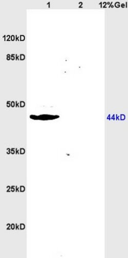 ABP/SHBG Rabbit anti-Human, Polyclonal, Bioss 100 &mu;L; Unconjugated:Antibodies,
