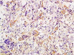 TWIST1 and TWIST2 Rabbit anti-Human, Polyclonal, Bioss 100 &mu;L; Unconjugated:Antibodies,