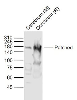 Patched Polyclonal Antibody, Bioss 100 &mu;L; Unconjugated:Antibodies,