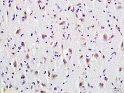 CD137 Rabbit anti-Human, Polyclonal, Bioss 100 &mu;L; Unconjugated:Antibodies,