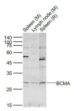 BCMA Polyclonal Antibody, Bioss 100 &mu;L; Unconjugated:Antibodies, Polyclonal
