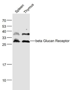 beta Glucan Receptor Rabbit anti-Human, Polyclonal, Bioss 100 &mu;L; Unconjugated:Antibodies,