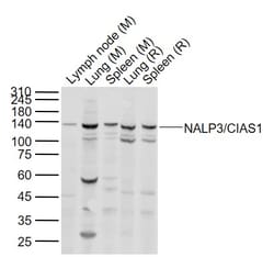 NALP3/CIAS1 Polyclonal Antibody, Bioss 100 &mu;L; Unconjugated:Antibodies,