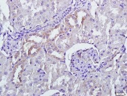 PERK Rabbit anti-Human, Polyclonal, Bioss 100 &mu;L; Unconjugated:Antibodies,