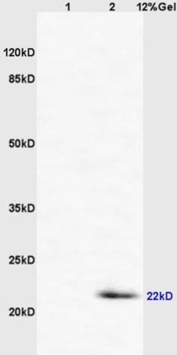 CD69/CLEC2C/AIM Rabbit anti-Human, Polyclonal, Bioss 100 &mu;L; Unconjugated:Antibodies,