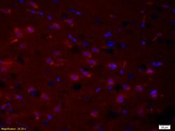 Phospho-PRKCB (Thr500) Rabbit anti-Human, Polyclonal, Bioss 100 &mu;L | Buy Online | Bioss | Fisher Scientific