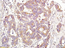 CD151 Rabbit anti-Human, Polyclonal, Bioss 100 &mu;L; Unconjugated:Antibodies,