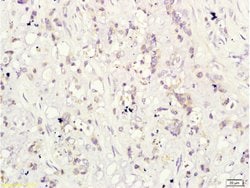 CD160/By55 Rabbit anti-Human, Polyclonal, Bioss 100 &mu;L; Unconjugated:Antibodies,