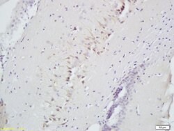 CD160/By55 Rabbit anti-Human, Polyclonal, Bioss 100 &mu;L; Unconjugated:Antibodies,