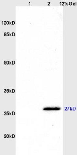 CD160/By55 Rabbit anti-Human, Polyclonal, Bioss 100 &mu;L; Unconjugated:Antibodies,