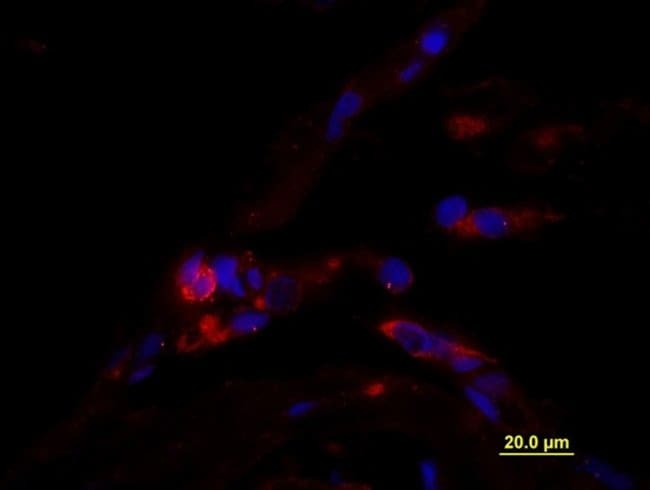 CD163/M130 Rabbit anti-Human, Polyclonal, Bioss 100 μL | Buy