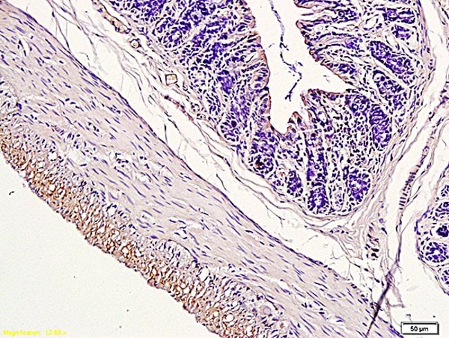CD163/M130 Rabbit anti-Human, Polyclonal, Bioss 100 μL | Buy