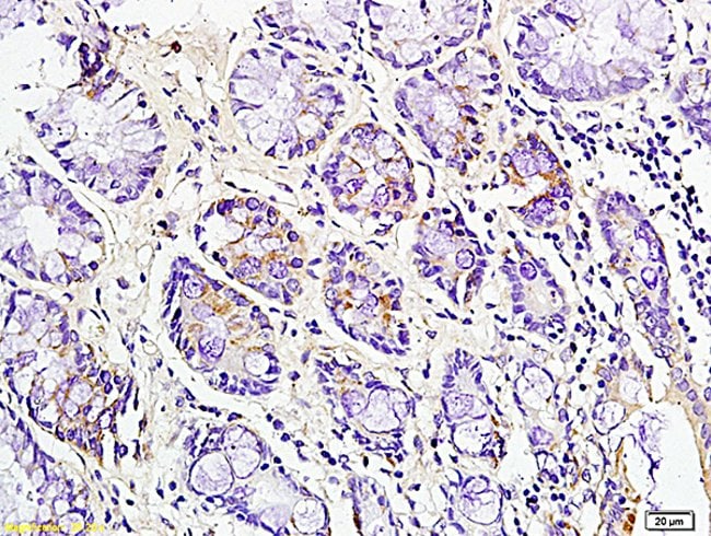 CD163/M130 Rabbit anti-Human, Polyclonal, Bioss 100 μL | Buy