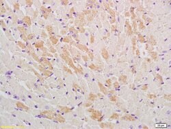 GLUT12 Rabbit anti-Human, Polyclonal, Bioss 100 &mu;L; Unconjugated:Antibodies,