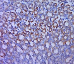 GLUT12 Rabbit anti-Human, Polyclonal, Bioss 100 &mu;L; Unconjugated:Antibodies,