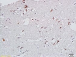 CXCL13/BCA1 Rabbit anti-Human, Polyclonal, Bioss 100 &mu;L; Unconjugated:Antibodies,