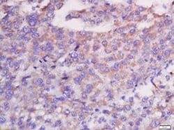 CXCL13/BCA1 Rabbit anti-Human, Polyclonal, Bioss 100 &mu;L; Unconjugated:Antibodies,