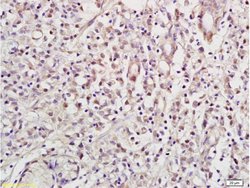 NRSF/REST Rabbit anti-Human, Polyclonal, Bioss 100 &mu;L; Unconjugated:Antibodies,