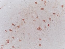 NRSF/REST Rabbit anti-Human, Polyclonal, Bioss 100 &mu;L; Unconjugated:Antibodies,