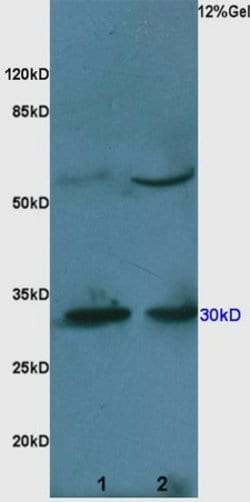 Caspase 3 Rabbit anti-Human, Polyclonal, Bioss 100 &mu;L; Unconjugated:Antibodies,