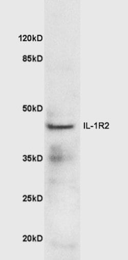 IL-1R2 Rabbit anti-Human, Polyclonal, Bioss 100 &mu;L; Unconjugated:Antibodies,