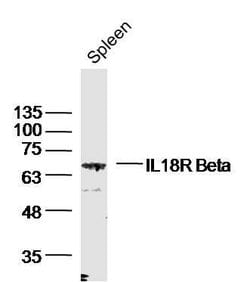 IL-18R Beta/CD218b Rabbit anti-Human, Polyclonal, Bioss 100 &mu;L; Unconjugated:Antibodies,