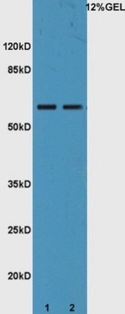 IL22RA1 Rabbit anti-Human, Polyclonal, Bioss 100 &mu;L; Unconjugated:Antibodies,