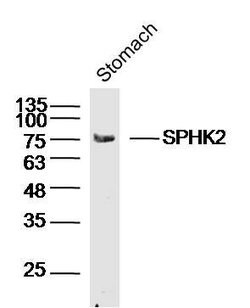 SPHK2 Rabbit anti-Human, Polyclonal, Bioss 100 &mu;L; Unconjugated:Antibodies,