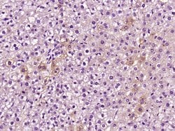 C5b-9 Rabbit anti-Human, Polyclonal, Bioss 100 &mu;L; Unconjugated:Antibodies,